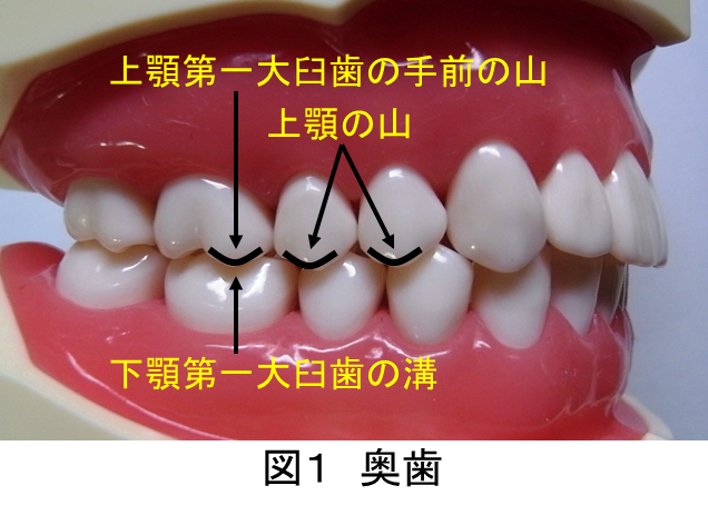 正しい噛み合わせとは どのような状態なのでしょうか 新宿の歯医者 歯科なら サンデンタルクリニック
