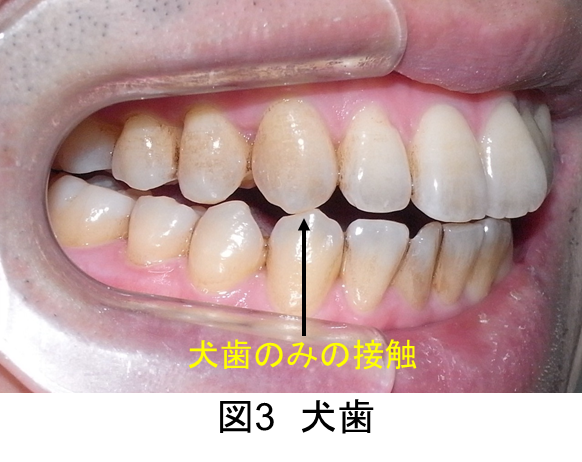 正しい噛み合わせとは どのような状態なのでしょうか 新宿の歯医者 歯科なら サンデンタルクリニック